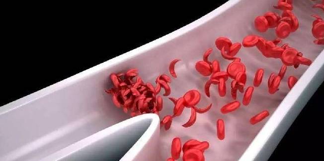 血管|早晨有了3种表现，最好去测一下血糖！可能是血糖升高了