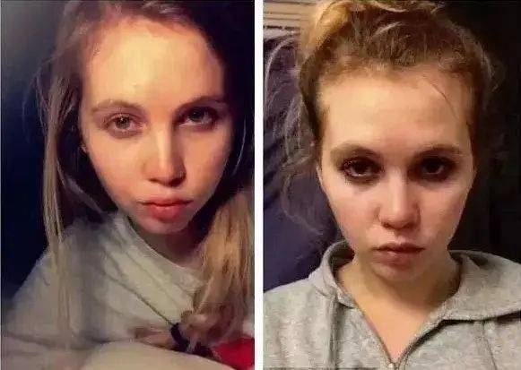 人间世|“长期熬夜”和“不熬夜”，40天后，差距惊人！