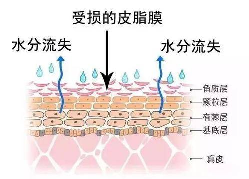 能力|重庆新依美美肤：皮肤屏障是什么？受损如何修复？