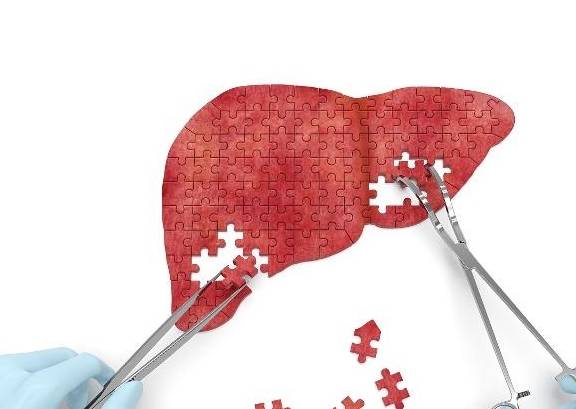 治疗|得了乙肝小三阳，需要做哪些检查？5种检查，其他别乱花钱