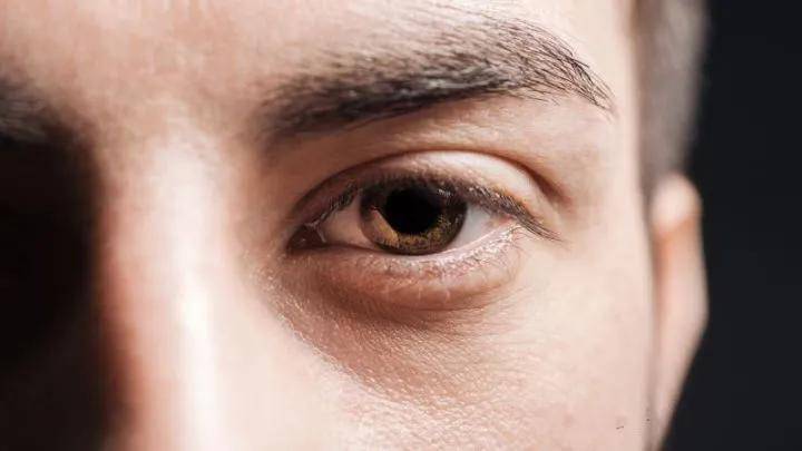 什么是单纯性突眼 8456579fec4d42e7824e1bf2da4b8f71.jpeg