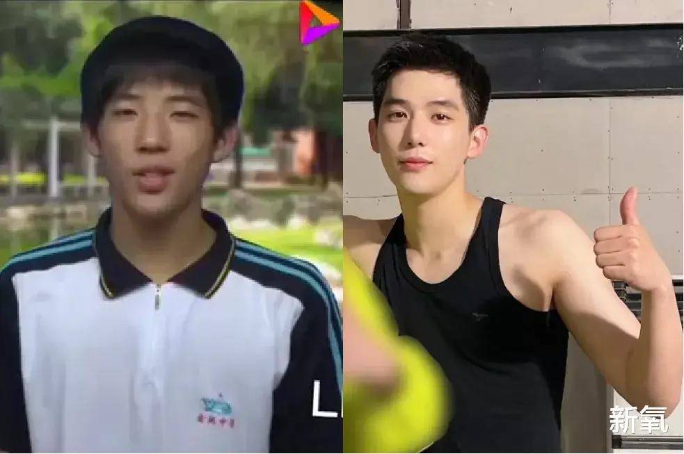 这让人震惊的变脸史,鞠婧祎看了也想求同款医生!_王安宇