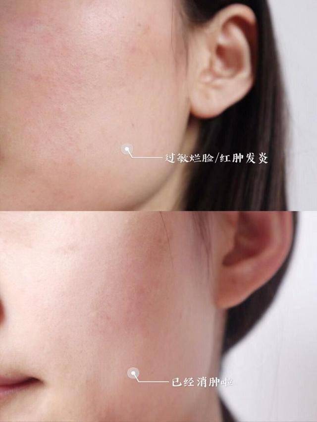 进行女人“素颜”好看是有原因的，当看到张馨予用的面霜后，恍然明白