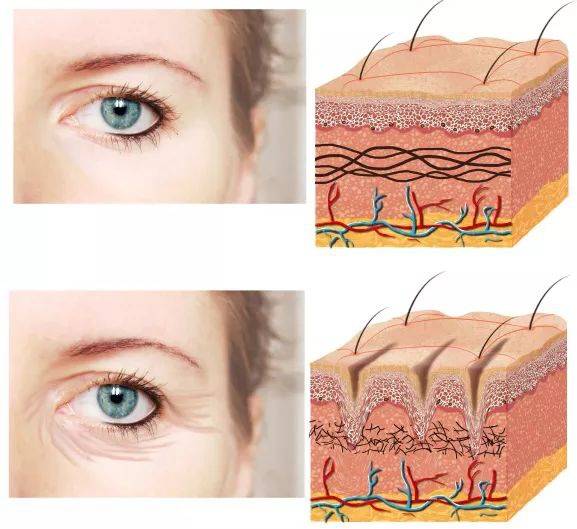 原液水媚蛙：导致皮肤衰老的两大主要原因