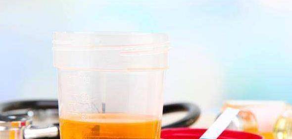 突袭|尿毒症不会“突袭”，肾脏不好，3个“信号”别再忽视了！