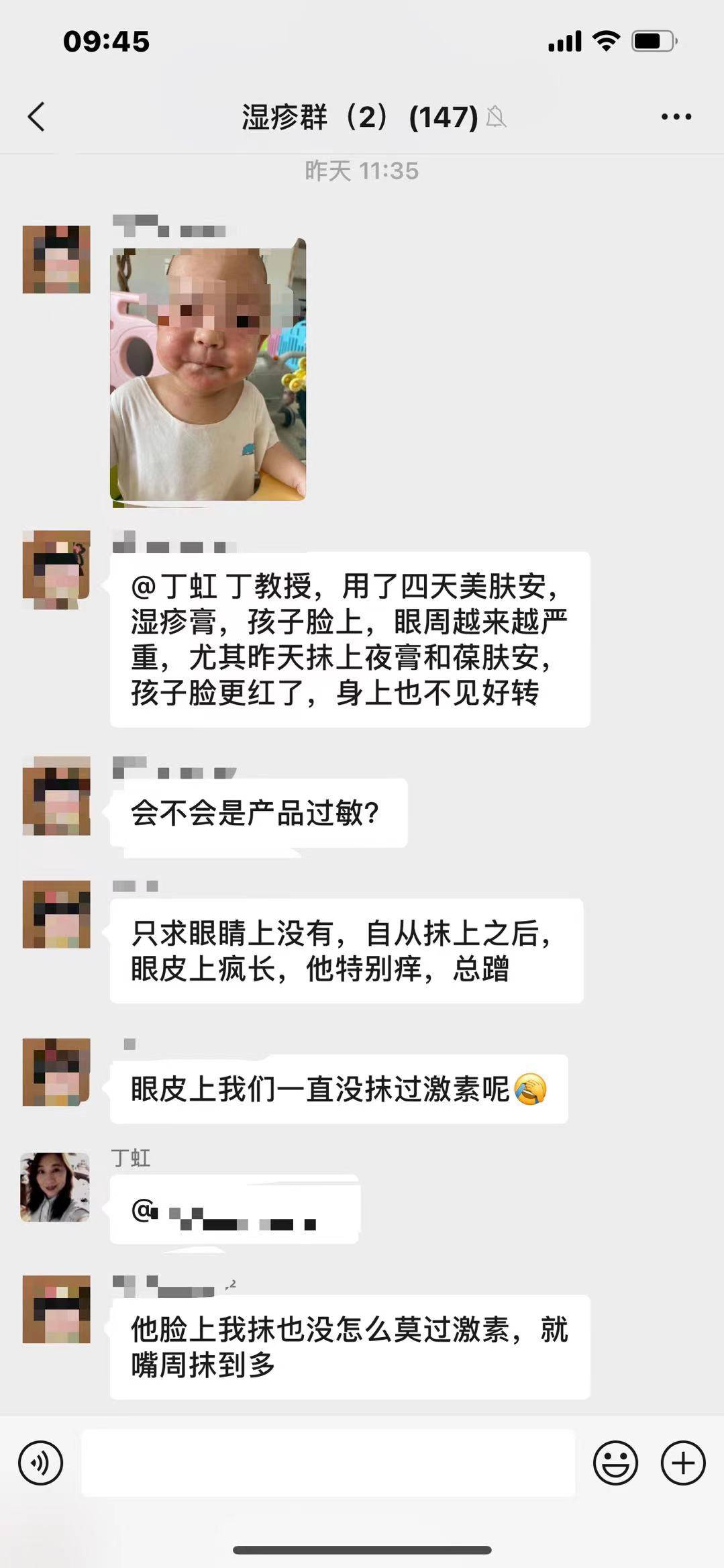 因为素简拾光:小孩子湿疹越来越严重应该如何护理?