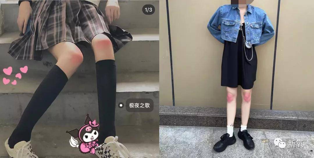 八卦爆料贵圈所谓的纯欲天花板，就是在关节上打腮红吗？