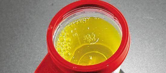 饮食|早上起床后，身体若没有3种表现，恭喜，你的肝脏还比较健康