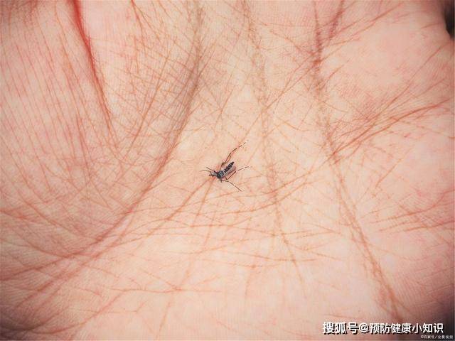 阻断|乙肝定会变成肝癌？对乙肝的这4个误解，早点知道比较好