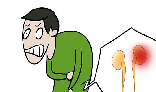 肾脏|肾结石对身体有什么影响?若掉以轻心,三种危害或会“如期而至”