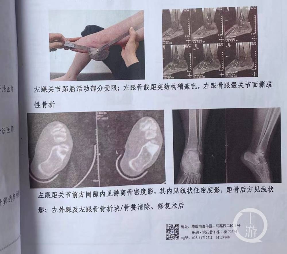 受伤后如何做伤残鉴定 75a18e79c94840b58a693ec6ea597ef1.jpeg