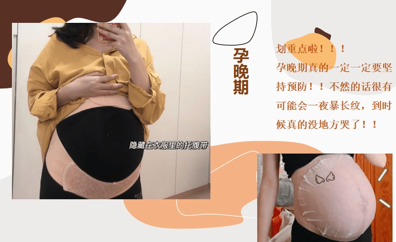 产品|张歆艺孕期0条妊娠纹，陈意涵二胎暴瘦，网友：谢依霖太惨了！