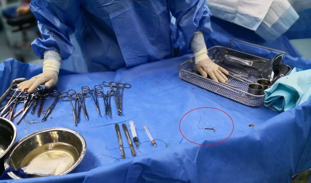 40年过去了,第1批放环的女性已经绝经,步入老年后现状如何了