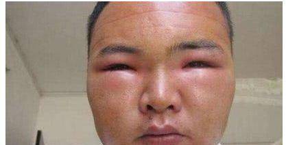 睡眠|“尿毒症”是“吃”出来的？提醒：生活中这4种食物尽量少吃