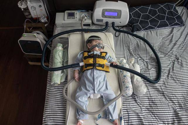 进行|一分钟带你了解运动神经元病的症状