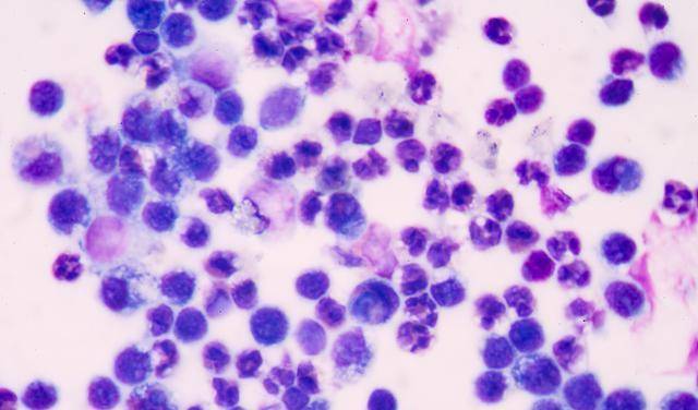 血常规|血常规检查中，若是这3个指标升高，别忽视了