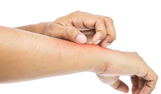 控制|皮肤是血糖的“晴雨表”，皮肤有4种表现，就是让你控糖的信号