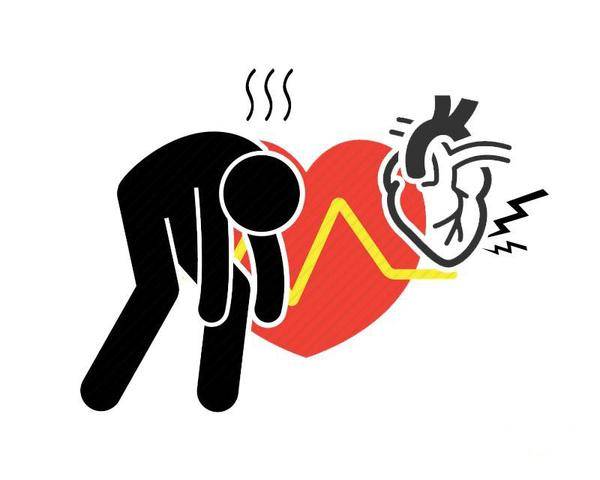 血管|心梗的“祸根”已找到，这3种早餐再不忌口，心梗可能随时恭候