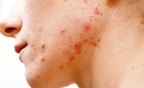 生活|肝毒“缠身”如何恢复？每天坚持“2动一吃”，肝脏或会干净如初