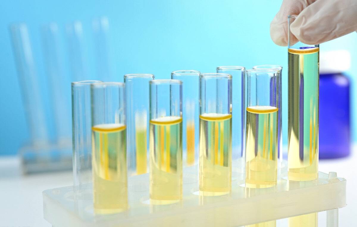 红细胞|尿隐血有了“加号”,要怎么办?要看血尿来自肾内还是肾外