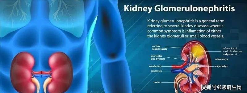 治疗|拯救肾病患者 - 干细胞移植有望代替透析、换肾