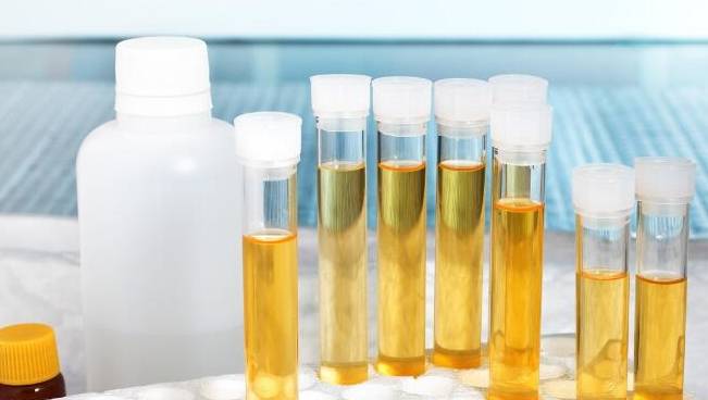 蛋白|此类药物是降尿蛋白的“利器”,尤其适合2类肾病