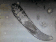 皮肤|曝光了!皮肤CT看到的痘痘竟然是这种画风!