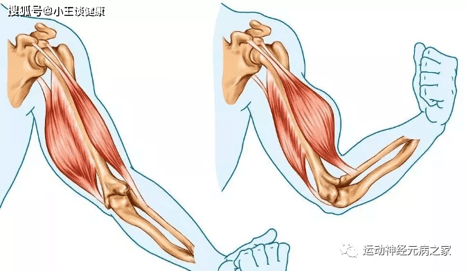 治疗|运动神经元病治疗32