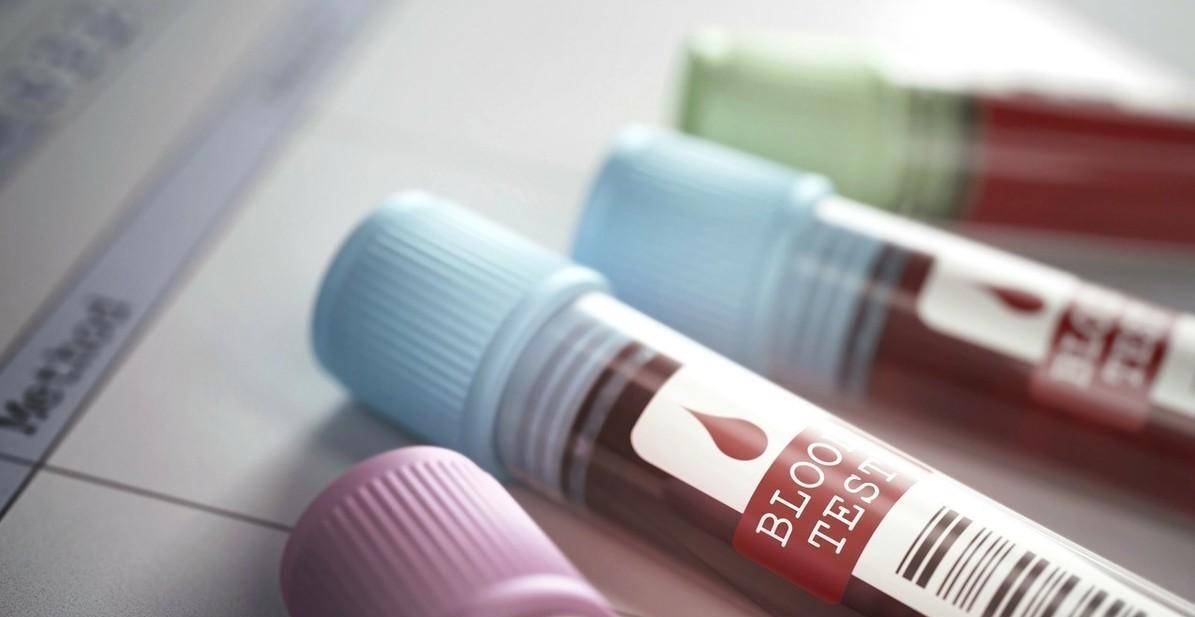 生活|“我才35岁就要做支架?”你虽然年轻,但是血管已经70岁了