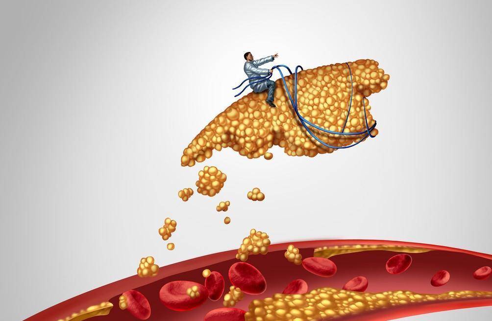 他汀|他汀类药物，什么人需要吃，血脂恢复到正常后可以停药么？