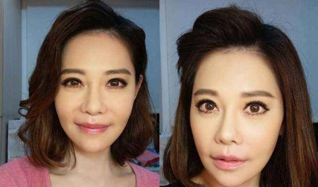 因为她是娱乐圈整容狂魔，连续整容高达60多次，后遗症却让她非常苦恼