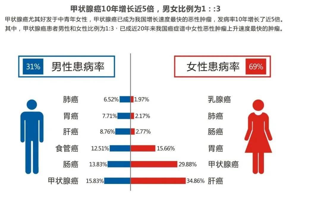 食管|张先慧主任分享:让甲状腺疾病治疗更高效,更精准!