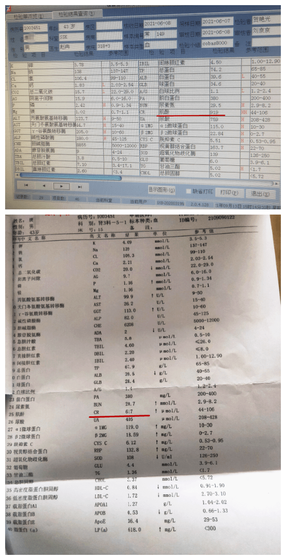 如果肌酐升高後,患者本身沒有出現呼吸困難,高鉀血癥,心衰,感染等嚴重