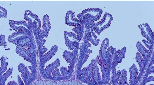 他汀|降脂新药依折麦布，疗效明确不伤肝，他汀好搭档，6类人特别适用