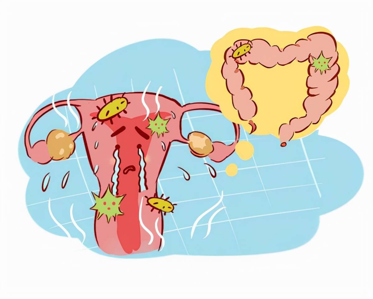 宫颈有癌,内裤先知?内裤若有4种迹象,女性越早检查越好!_阴道