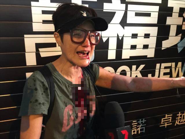 王馨平近期在接受访问时却提起了这件事2021年10月25日