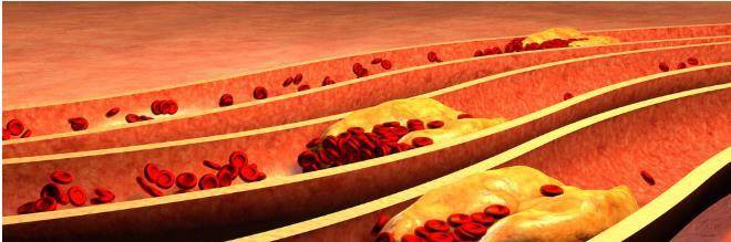 肾脏|不想加速肾衰竭恶化，只降蛋白还不够，做好3点尤为关键