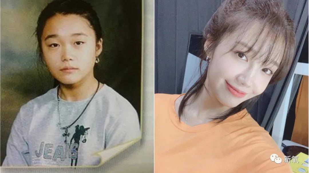 整形整形天选之人vs整完只会吓人，区别在哪里？