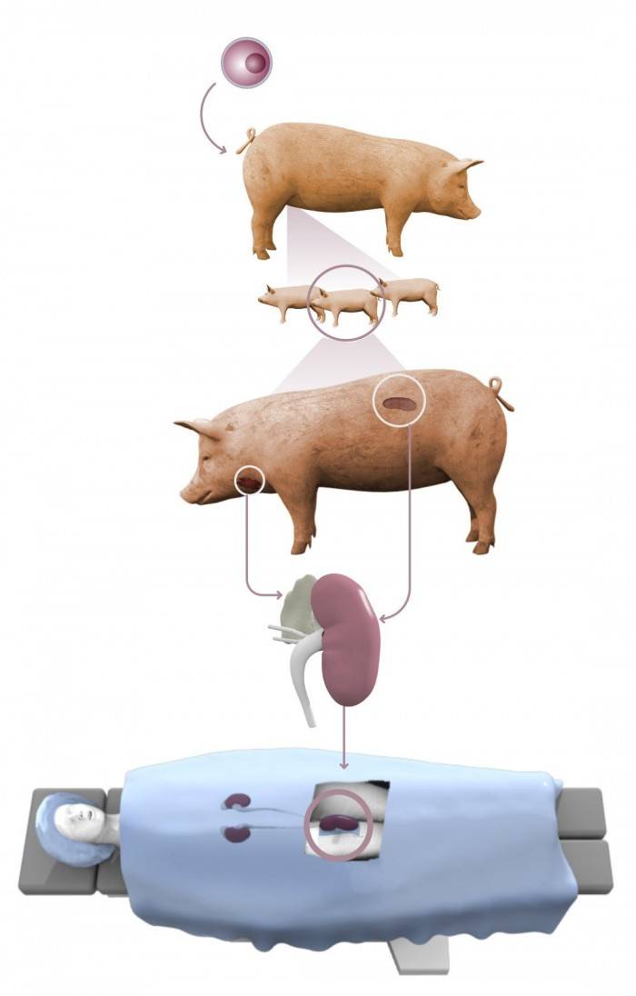 正常工作|猪肾脏成功用于人体移植 正常工作了54小时