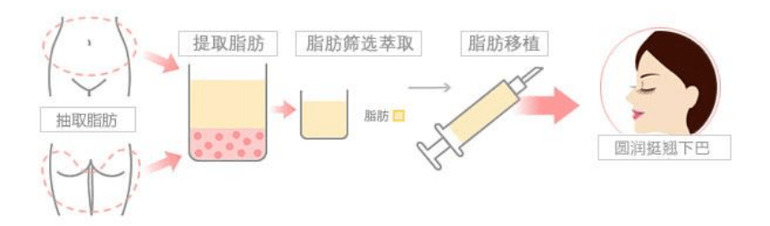 下巴看看自体脂肪下巴填充图片毁容了、谁还敢做？