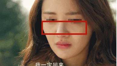 颧骨拉垮颜值的“印第安纹”，终于找上了95后