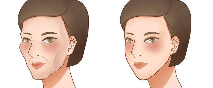 时间同样是凹陷为什么别人可以用玻尿酸，而我用自体脂肪填充？