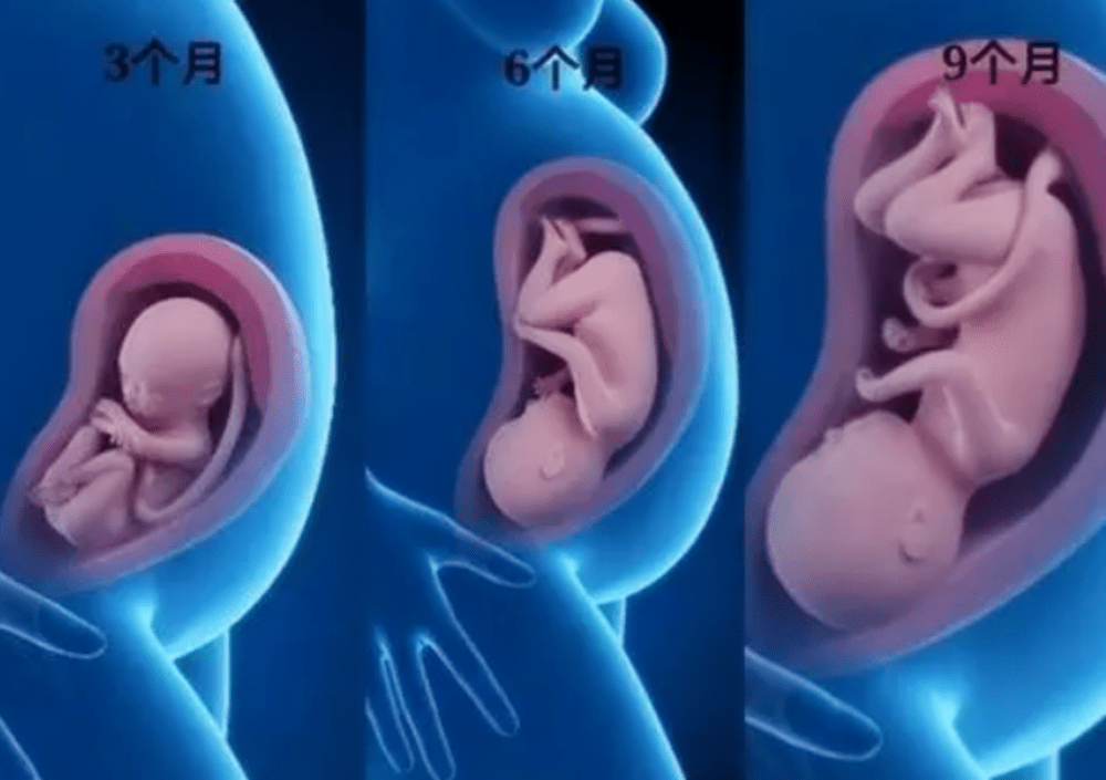 怀孕9个月的胎儿图片图片