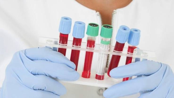 关键|肾病预防尿毒症只看血肌酐?你就错了!这2项指标才是关键