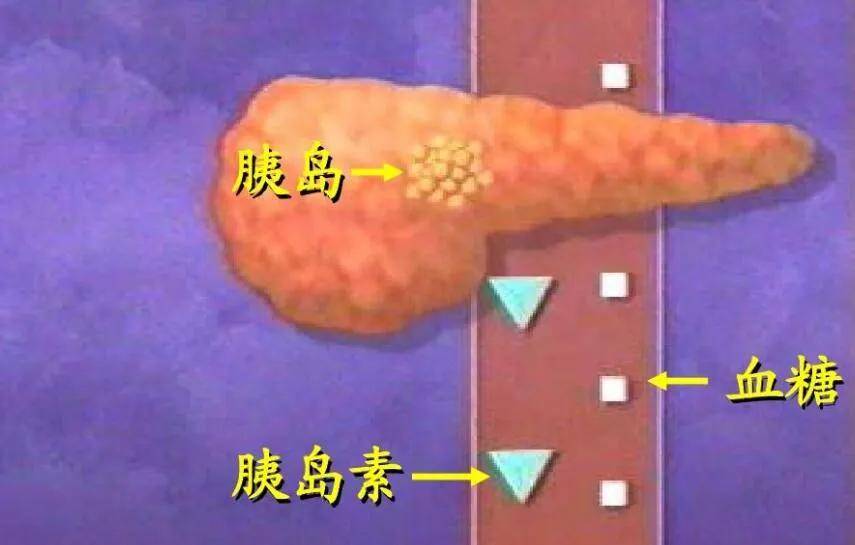 治愈|逆转糖尿病,要怎么做?
