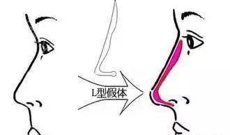 整形这是我见过最敢的女星,猪鼻子还能演美女?