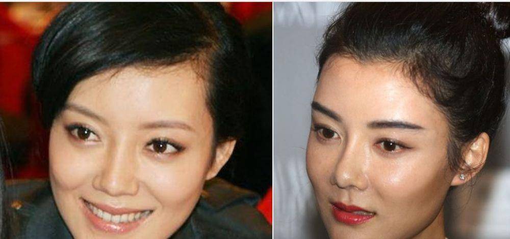 整形这是我见过最敢的女星,猪鼻子还能演美女?