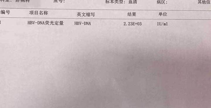 hbv-dna|48岁查出肝损伤,一年后发现早期乙肝肝硬化,早期肝硬化能治好吗
