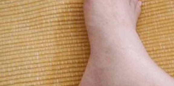 降低|长期打胰岛素有副作用?这4种食物,每天换着吃一些,有助降血糖