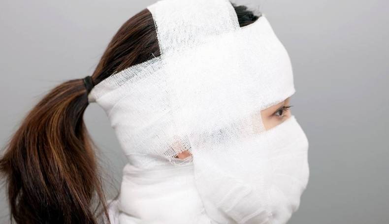整形女子花4万做整形头顶变秃？怒找媒体曝光，网友列7项“标准”回复